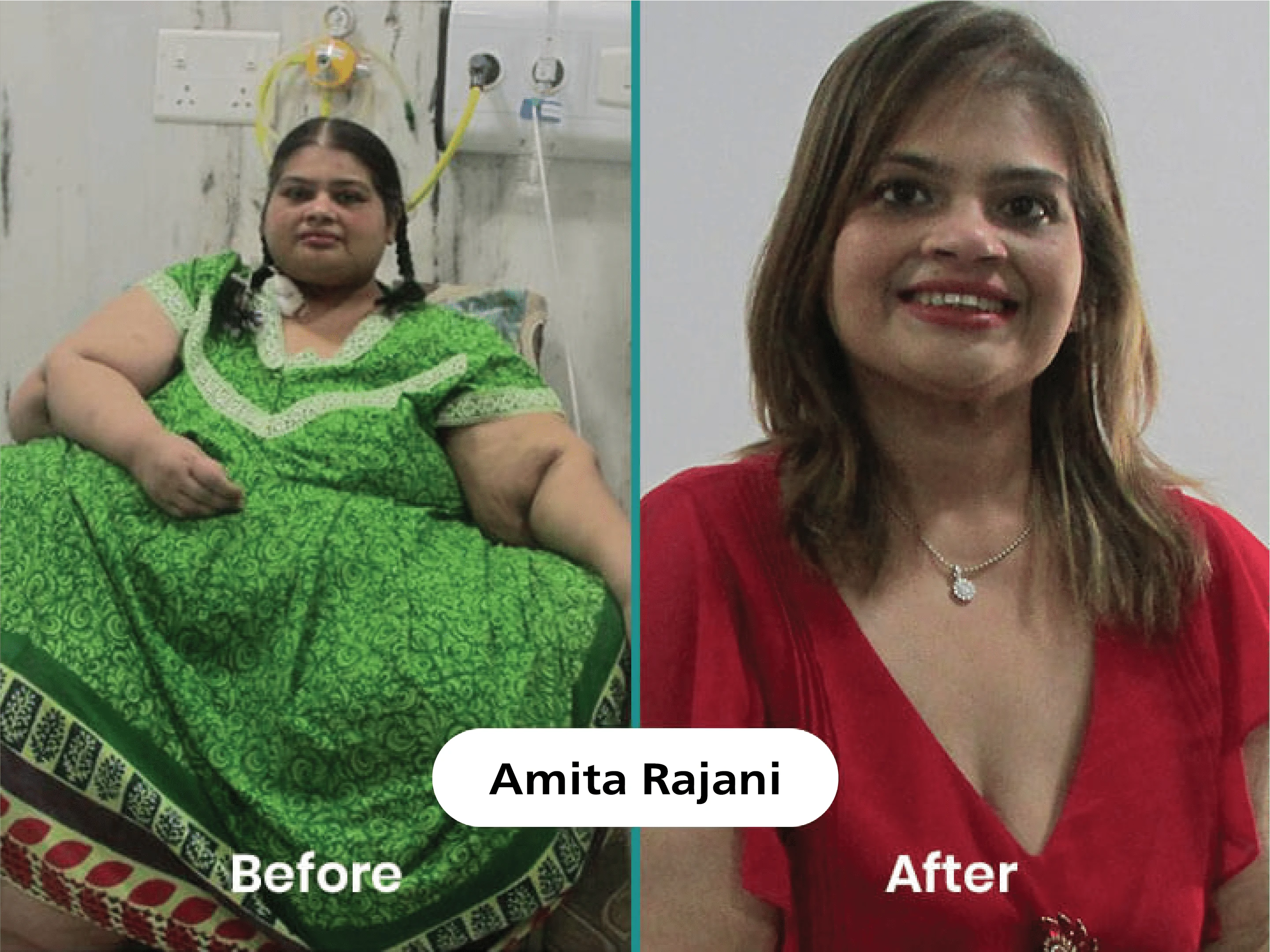 Before & After 3