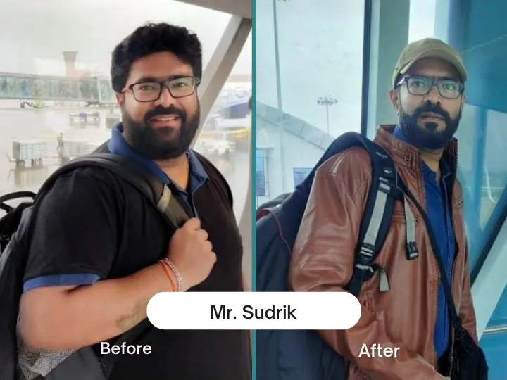 Before & After 9