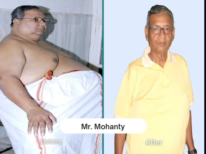 Before & After 1