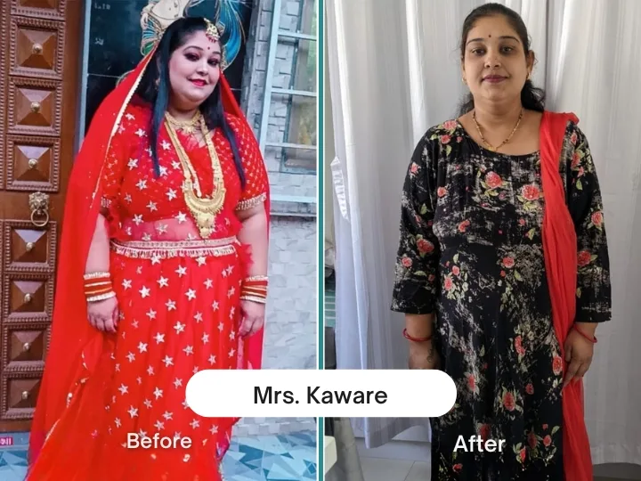 Before & After 7