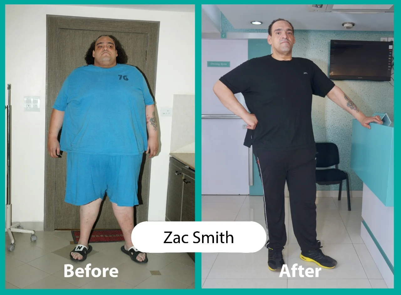 Before & After 5