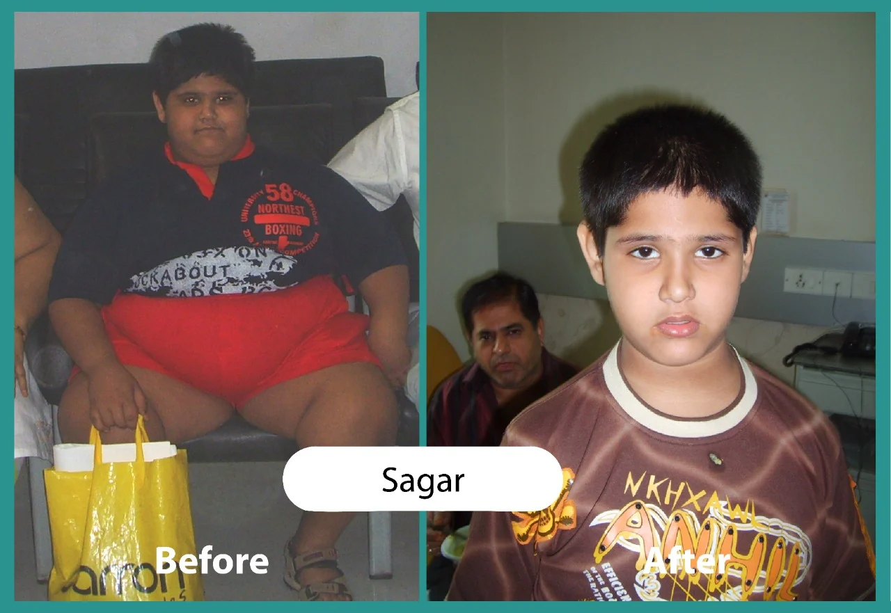 Before & After 4